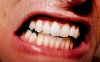 Saiba o que  Bruxismo e como prevenir